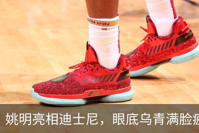 姚明亮相迪士尼，眼底乌青满脸疲惫，一身伤病走路一瘸一拐太沧桑